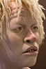 African-Teen-with-Albinism-2